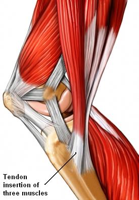 TENDONES TENDINITIS tendones tendinitis: