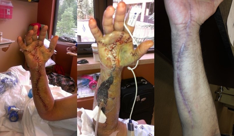 Knee surgical operation healing supplements