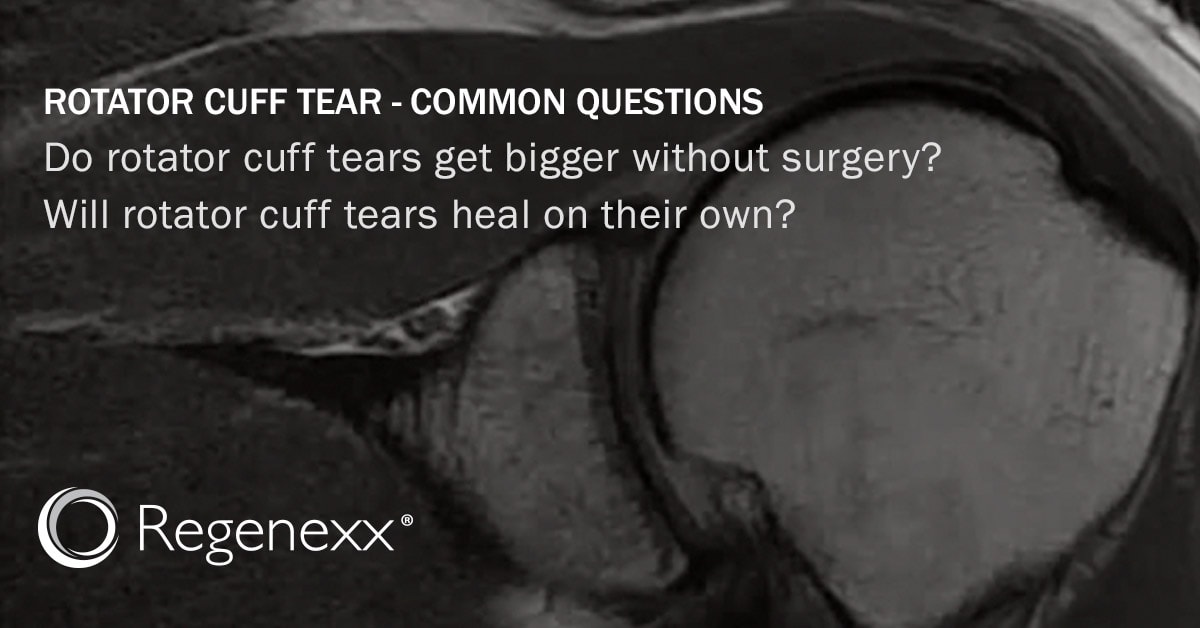 Will A Rotator Cuff Tear Heal Without Surgery?
