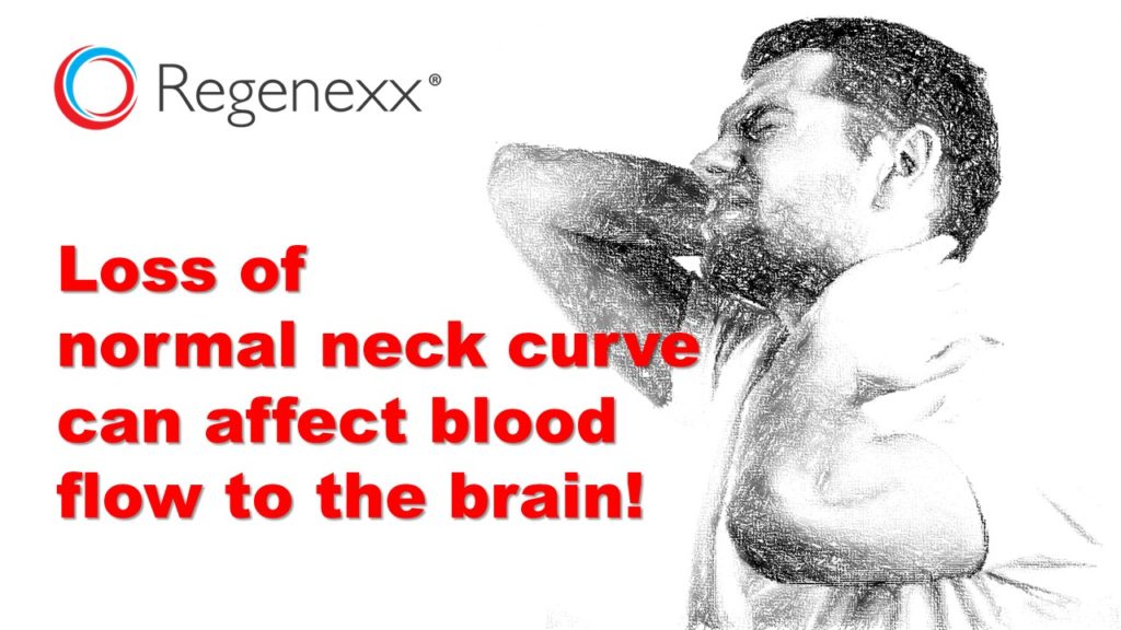 what is straightening of the normal cervical lordosis
