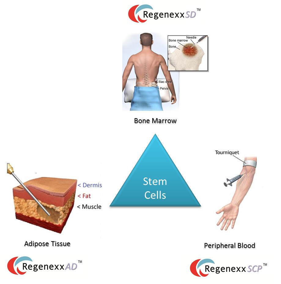 Having Many Stem Cell Sources In The Toolbox Benefits The Patient