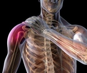 Shoulder rotator cuff tear healing shoulder rotator cuff tear healing