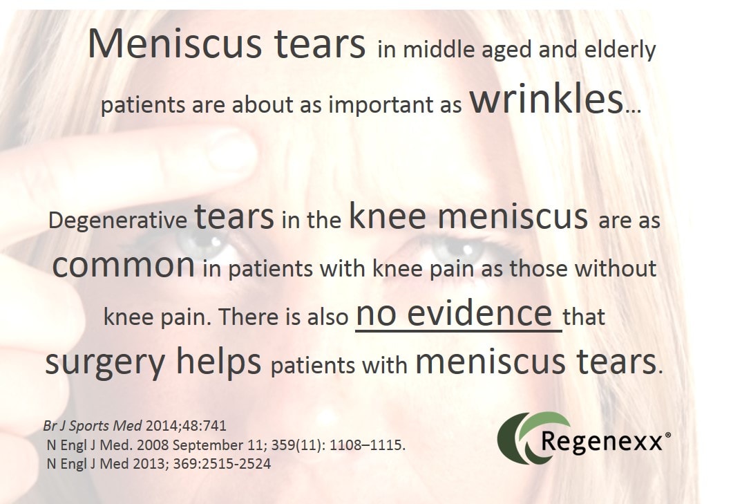 Meniscus Tear Surgery or Not? Meniscus Tears are Like Wrinkles