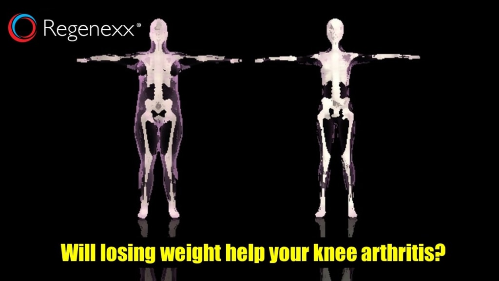 Which is better white kidney bean extract or garcinia cambogia image 2