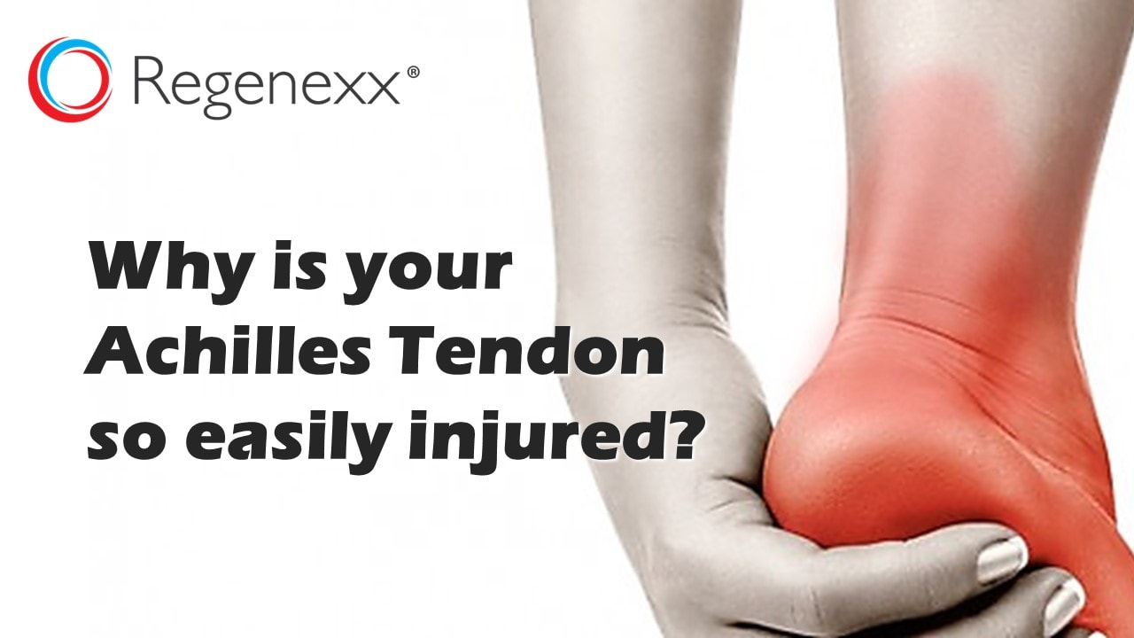 Achilles tendon: causes of damage, treatment and prevention 51 Achilles tendon: causes of damage, treatment and prevention 58